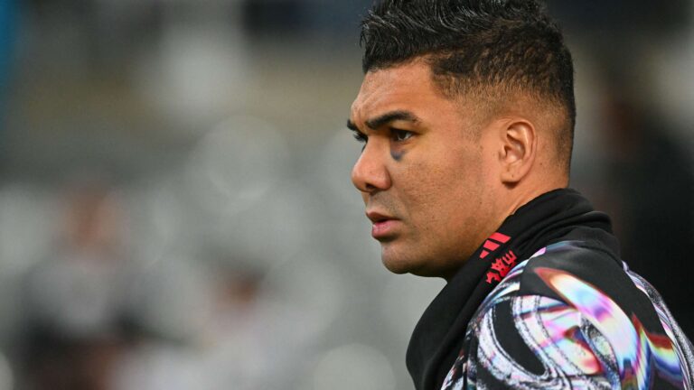 สาเหตุรอยฟกช้ำตา Casemiro เปิดเผยก่อนเกม แมนเชสเตอร์ ยูไนเต็ด พบ นิวคาสเซิล