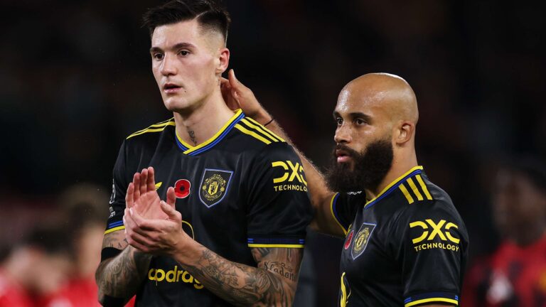 แมนเชสเตอร์ ยูไนเต็ด อัปเดตอาการบาดเจ็บ เซสโก้ และเอ็มเบูโม ถอนตัวจากทีมชาติ