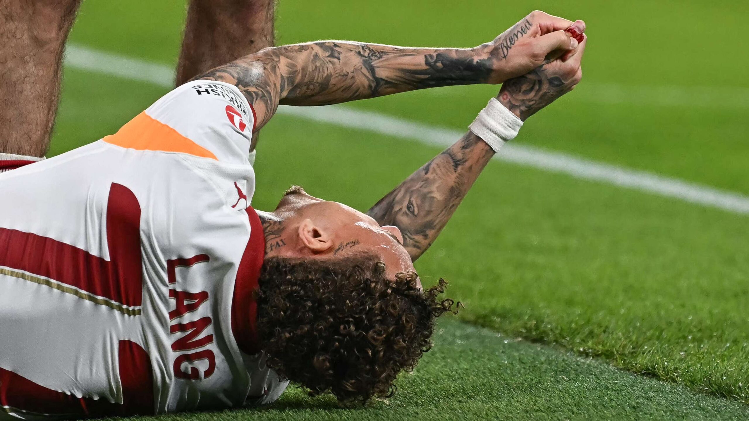 โนอา ลังเผยยังทนทุกข์จากอาการบาดเจ็บหัวแม่มือที่ติดกับป้ายโฆษณาหลังชนในเกมกาลาตาซารายบุกลิเวอร์พูล พ่าย 0-4 ในยูฟ่าแชมเปียนส์ลีก