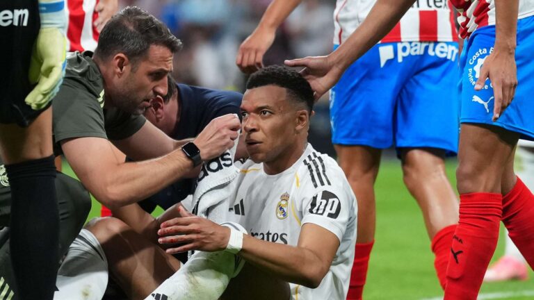 เอ็มบัปเป้เผยรอยแผลบนใบหน้า หลัง เรอัล มาดริด เสมอกีโรนา 1-1 ในลา ลีกา